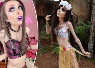 Eugenia Cooney’s ‘thin’ figure sparks worry amid eating disorder: