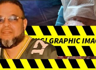 Wisconsin Man Claims Botched Surgery Left Him with Disgusting Wound