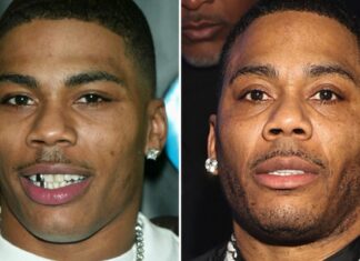 Nelly — Good Genes Or Good Docs?!