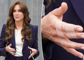 Kate Middleton visits prison with a mysterious hand injury