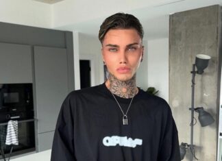 Levi Jed Murphy Is Ready for His Fifth Round of Plastic Surgery