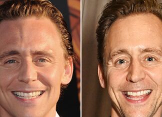 Tom Hiddleston — Good Genes Or Good Docs?!
