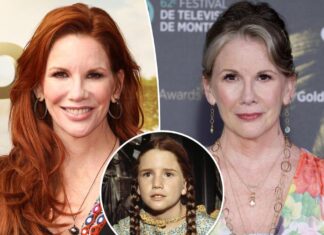 Melissa Gilbert says Botox left her looking like the ‘spawn of Satan’