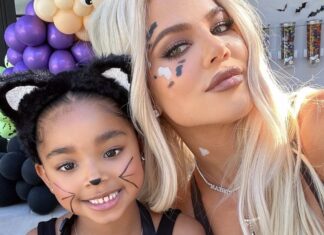 How Khloe Kardashian’s Daughter True Thompson Lost Her Front Tooth