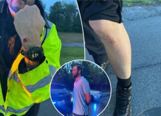 Photos of officer’s injuries from Scottie Scheffler arrest revealed