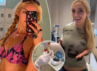 Women are rushing to NYC’s ‘Cleavage Clinic’ for non-surgical, all-natural boob jobs — that cost half the price of implants