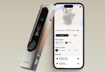 Withings brings AI-powered heart and lung checkups to your home with BeamO